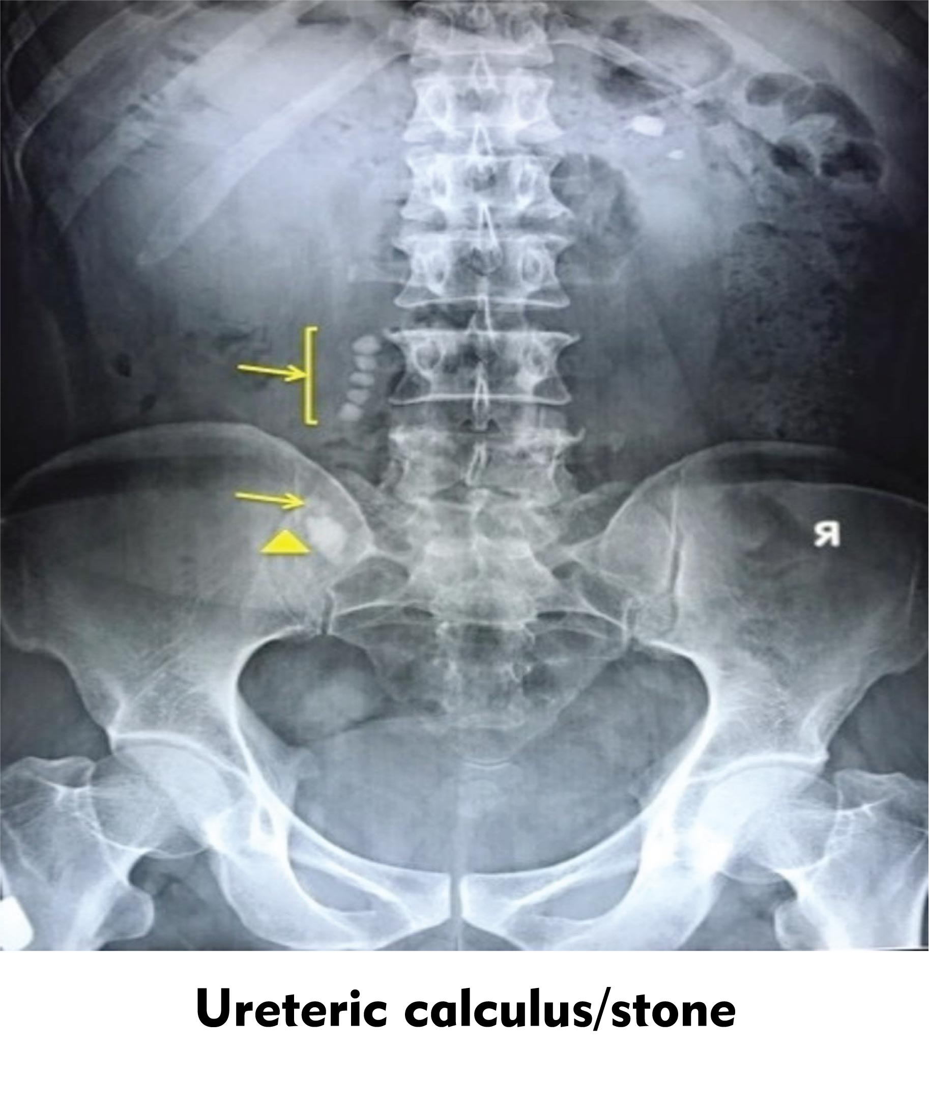 Abdominal X Ray Labeled