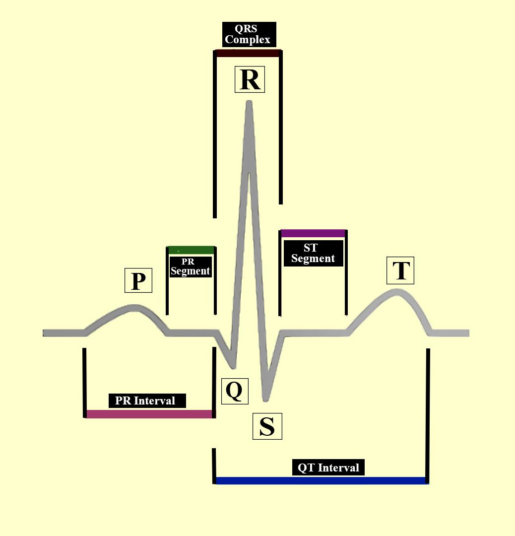 In an ECG, the depolarization of atria is indicated bya) P-waveb) Q ...