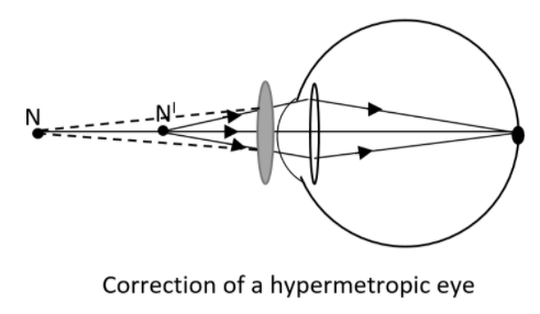 Parts Of A Ray Diagram