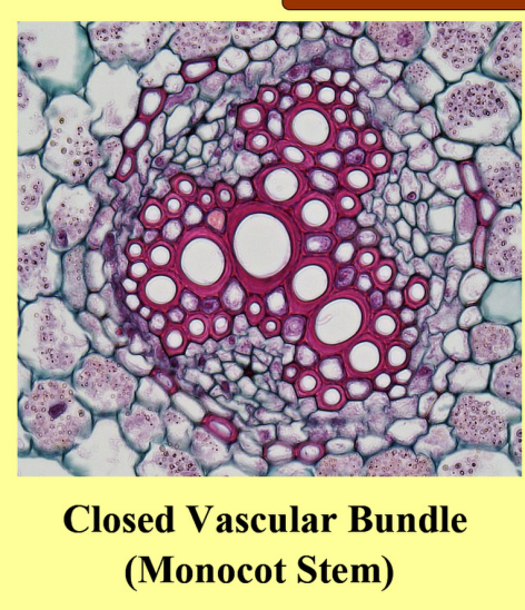 Vascular Bundle Wikipedia