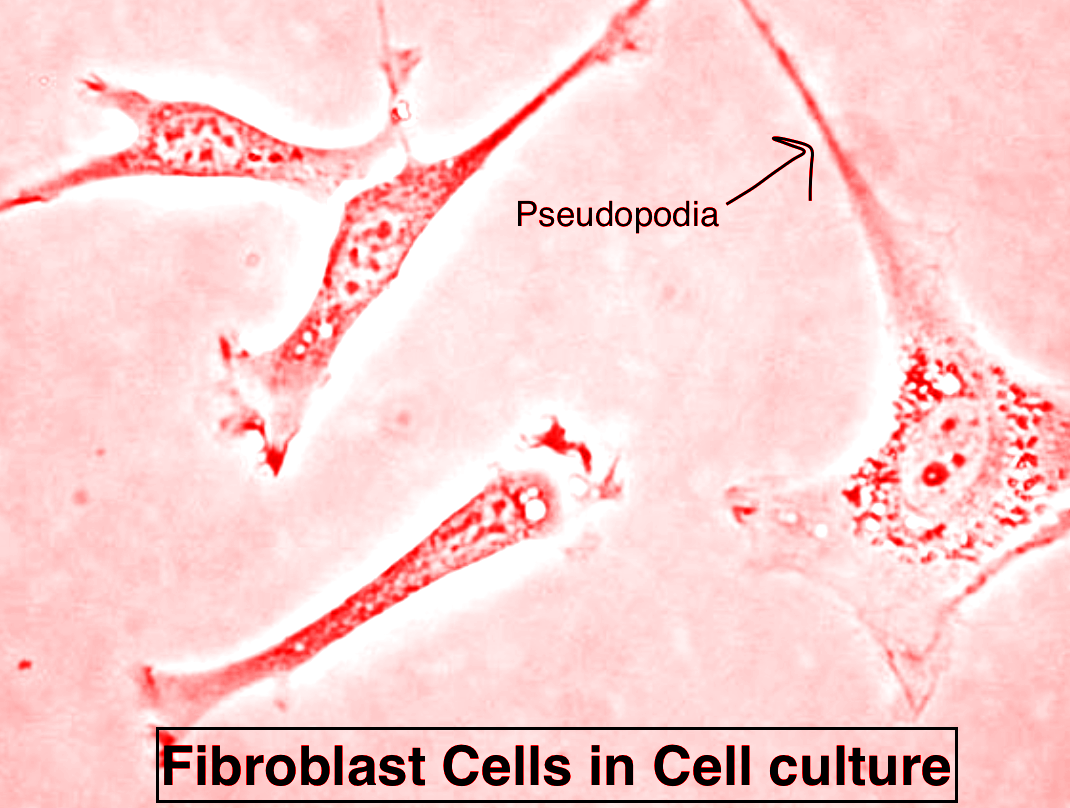 pseudopodia in a cell