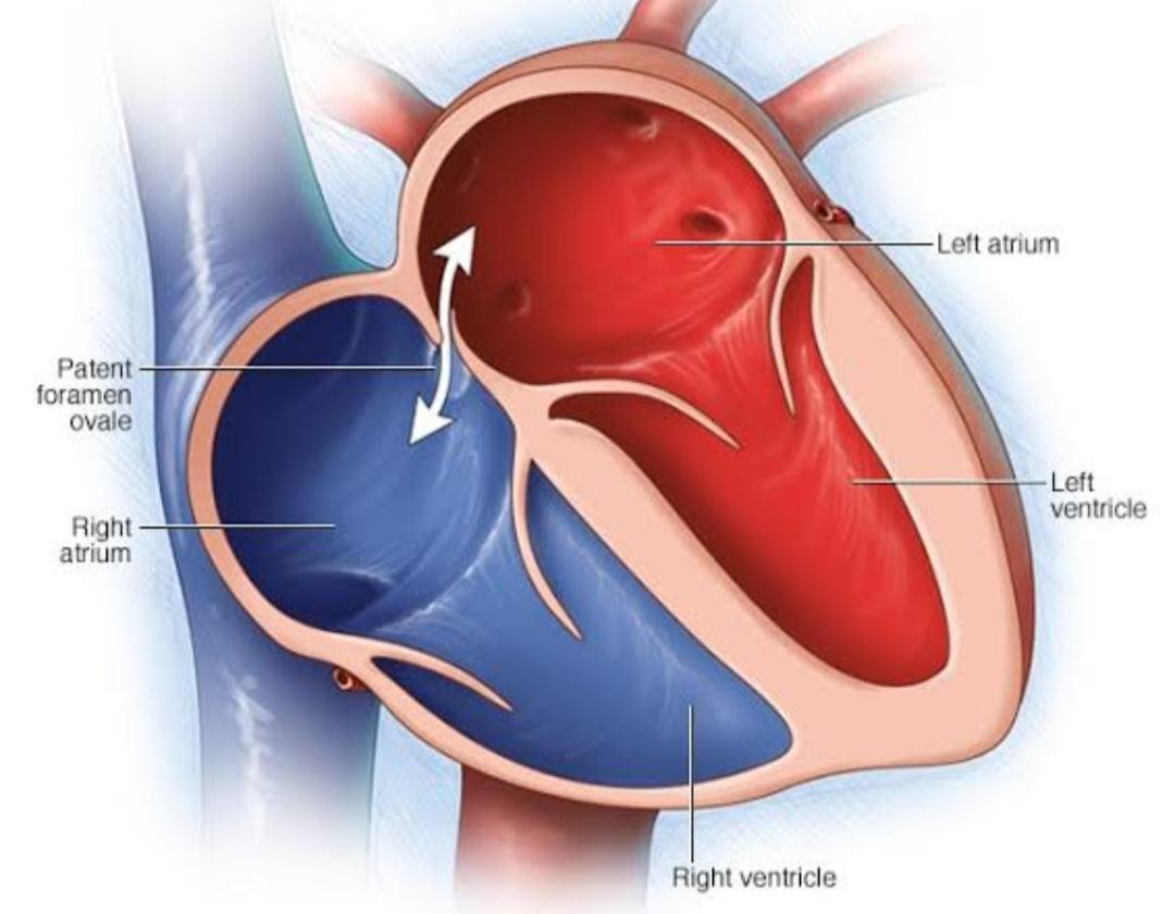 What is the foramen ovale?