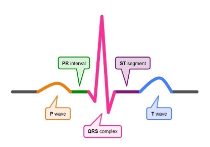 labelled diagrammatic representation of a standard ECG