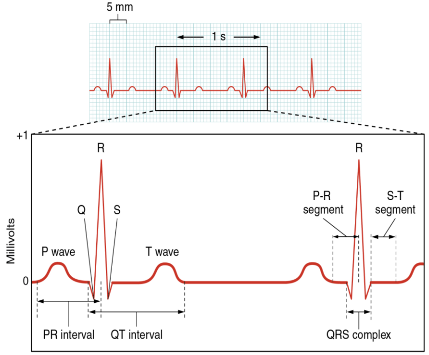 ECG Diagram