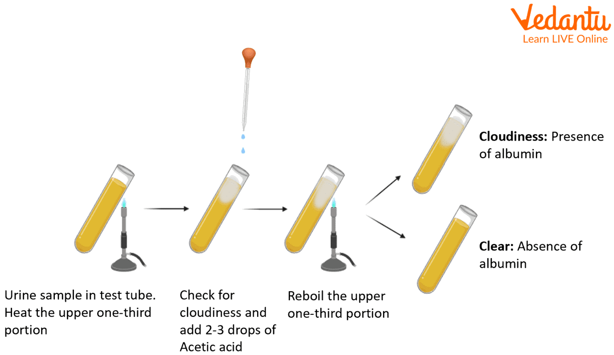 Test for the presence of albumin in the urine