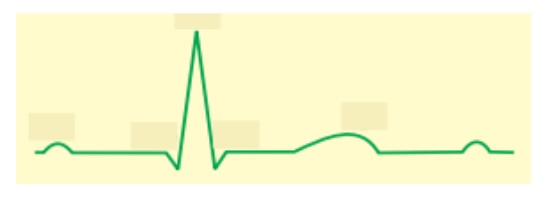 diagrammatic representation of a standard ECG