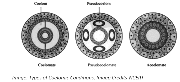 Types of Coelomic Conditions